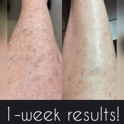 1-Week-Leg