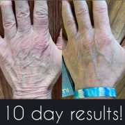10-Days-Hands