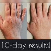 10-Days-Hands1