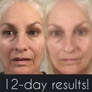 12-Days-Full-Face