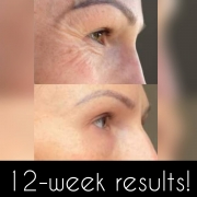 12-Weeks-Eyes