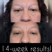 14-Weeks-Eyes