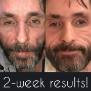 2-Week-Full-Face