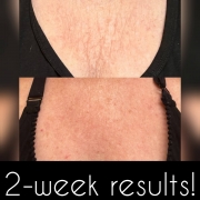 2-Weeks-Chest