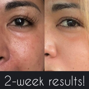 2-Weeks-Eyes