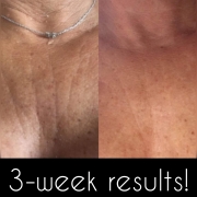 3-Weeks-Chest