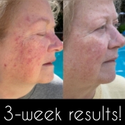 3-Weeks-Face