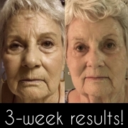 3-Weeks-Full-Face
