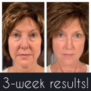 3-Weeks-Full-Face1