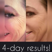 4-Days-Face-and-Eyes