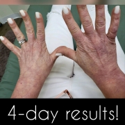 4-Days-Hands