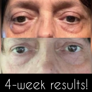 4-Weeks-Eyes