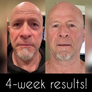 4-Weeks-Full-Face2