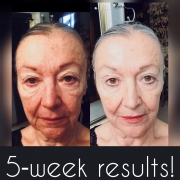 5-Weeks-Full-Face