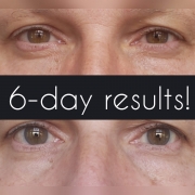 6-Days-Eyes-1