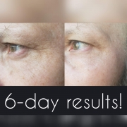 6-Days-Eyes-2