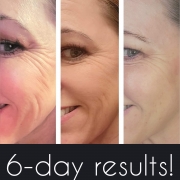 6-Days-Face-and-Eyes