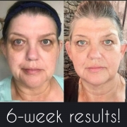 6-Weeks-Full-Face