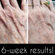 6-Weeks-Hands
