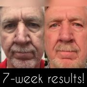 7-Weeks-Full-Face