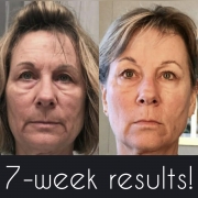 7-Weeks-Full-Face1