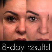 8-Days-Face