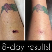8-Days-Legs