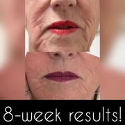 8-Week-Mouth