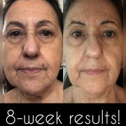 8-Weeks-Full-Face